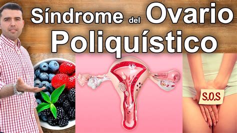 Ovarios Poliquisticos Cura Quistes De Ovario Remedios Naturales My Xxx Hot Girl
