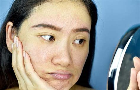 Makeup Tips For Sallow Skin Tone Mugeek Vidalondon