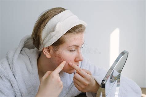 Acne A Teenage Girl Looks In The Mirror At Her Problematic Skin And