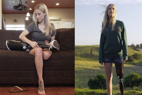 A Young Veteran Opens Up About Losing Her Leg And Contemplating Suicide