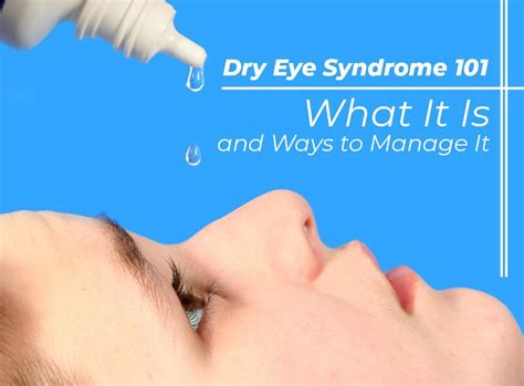 Dry Eye Syndrome 101 What It Is And Ways To Manage It