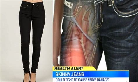 Skinny Jeans Cause Nerve Damage Doctors Warn