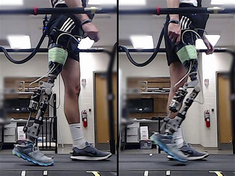 Ai Helps Amputees Walk With A Robotic Knee