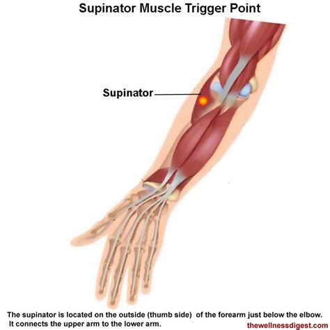 Supinator Muscle Pain The Wellness Digest