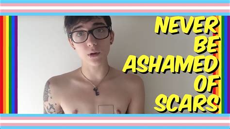 Not Ashamed Of Battle Scars Trans Pride Youtube
