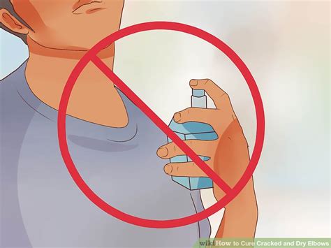 How To Cure Cracked And Dry Elbows 14 Steps With Pictures
