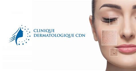 Dermatologie Médicale Clinique Dermatologique Cdn