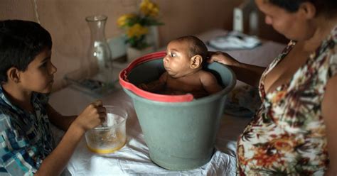 Brazil Blames Zika Virus For Devastating Birth Defects