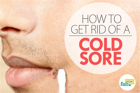 How To Get Rid Of A Cold Sore Overnight Fab How