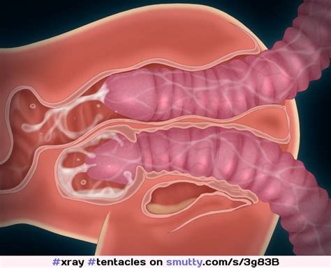 Anatomia Pulmonar Menbranas Sexiz Pix