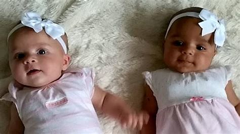 Black Twin White Twin Mum Gives Birth To Twins With Different Skin