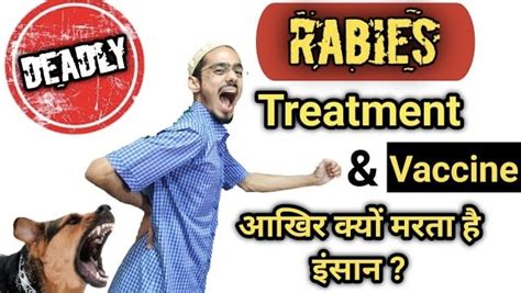 What Is Rabies Virus Physio Talk Official
