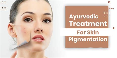 Ayurvedic Treatment For Skin Rashes Archives Shuddhi