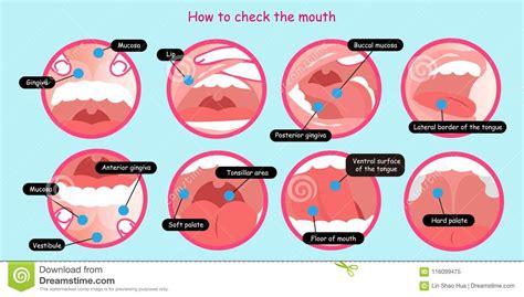 How To Check The Mouth Stock Illustration Illustration Of Caricature