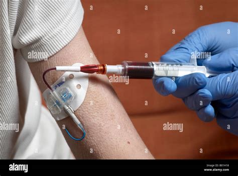 Drawing Blood From A Picc Line With Surgical Gloves Peripherally