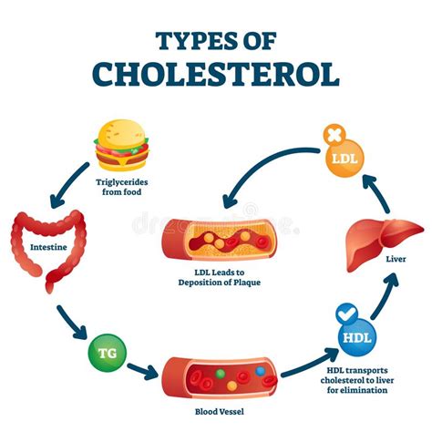 Types Of Cholesterol Educational Cycle Scheme From Fatty Food To Ldl