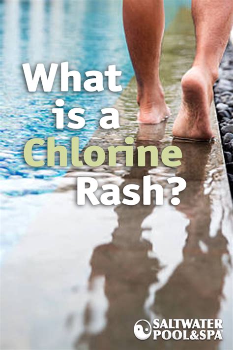 What Is A Chlorine Rash Chlorine Water Pool Chlorine Saltwater Pool