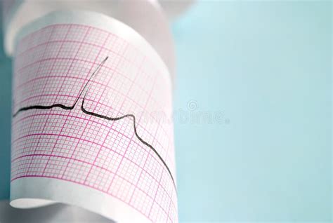 Cardiogram Stock Image Image 28119391