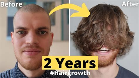💇🏻💈hair Growth Time Lapse 2 Years 24 Months Men From Buzz Cut Youtube