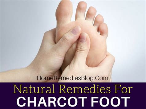 9 Effective Natural Treatments For Diabetic Charcot Foot Home Remedies Blog
