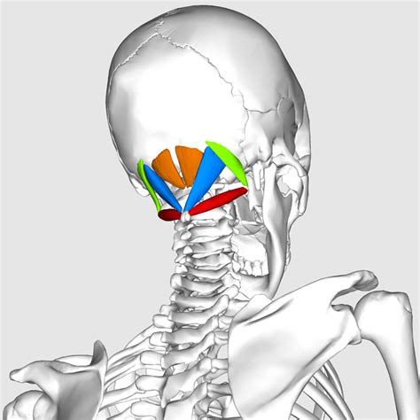 Prolotherapy For Suboccipital Headache Caring Medical Yoga Therapy