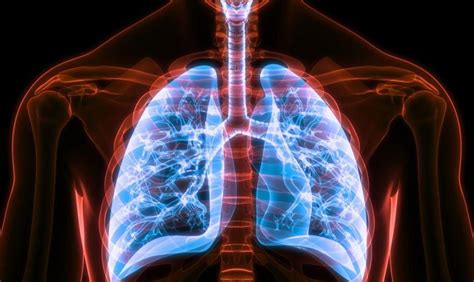 Atas dasar kesemua sumber negatif ini, berikut disenaraikan 8 jenis penyakit kronik yang berkaitan dengan sistem respirasi manusia Inilah Proses Respirasi Manusia dan Berbagai Penyakitnya