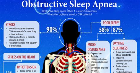 Infographic On Obstructive Sleep Apnea Osa Fauquier Ent Blog