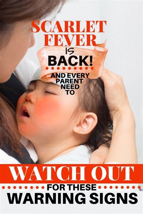 Scarlet Fever Returns And Here Are The Warning Signs You Must Know