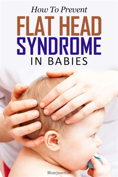 Flat Head Syndrome In Babies 4 Ways To Prevent It Flat Head Syndrome
