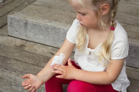 Dermatita Atopica La Copii Cauze Simptome Tratament
