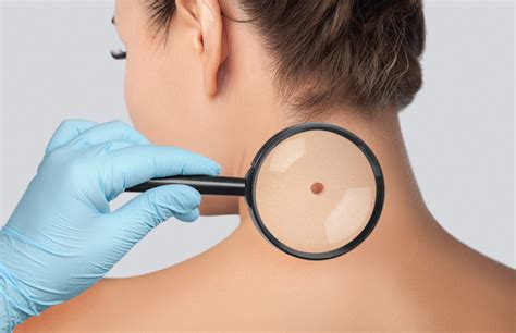 Skin Cancer Excision Reconstruction • Hawaii Dermatology And Plastic