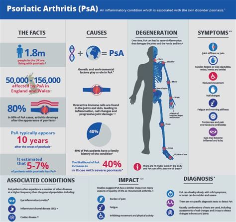 17 Best Images About Psoriasis Arthritis On Pinterest University Of