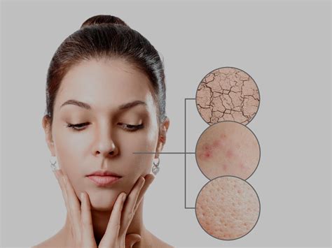 How To Determine Your Skin Type Onlymyhealth