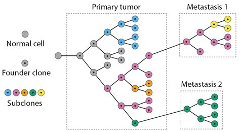 Penn Software Helps To Identify Course Of Cancer Metastasis Tumor