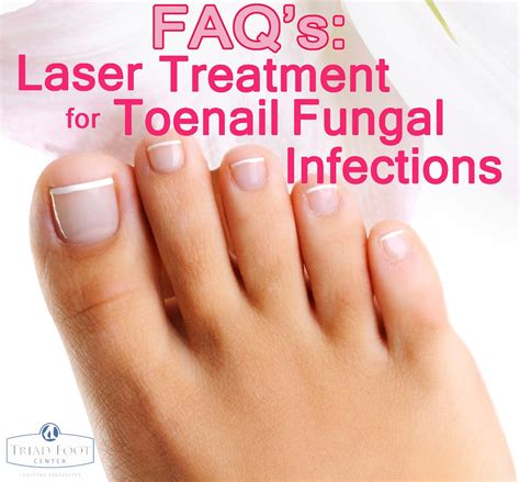 Pin By Diann Parker On Beauty Laser Treatment Toe Nails Toenail Fungus