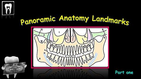 Panoramic Radiography Landmark Dental Radiology Orthopantomogram Opg