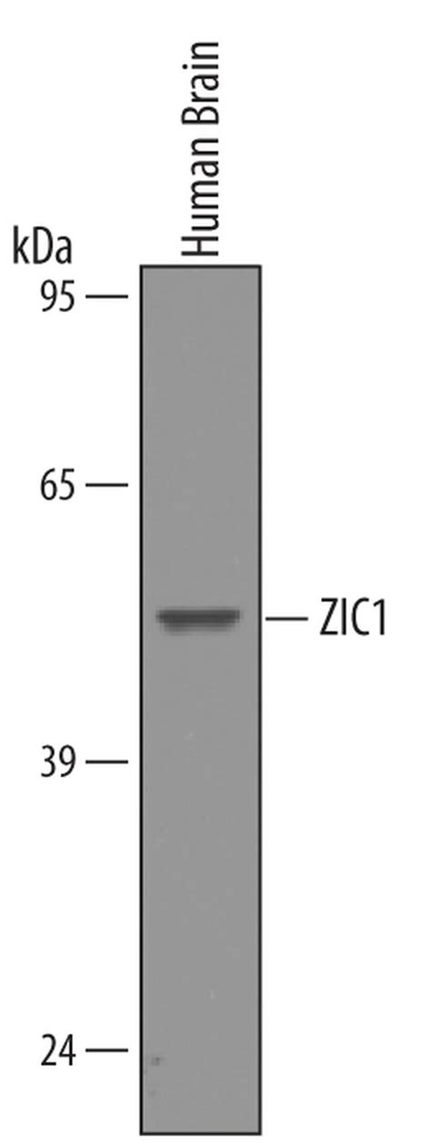 Zic1 Antibody Pa5 47681