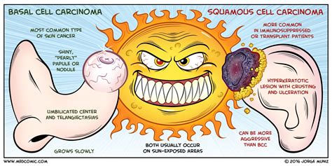 Basal Cell Carcinoma Vs Squamous Cell Carcinoma Medcomic