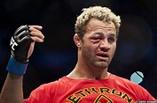 US Josh Koscheck’s right eye was badly b | MMA Junkie