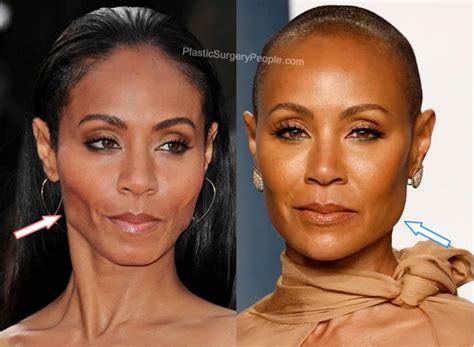 Jada Pinkett Smith Before And After 2022