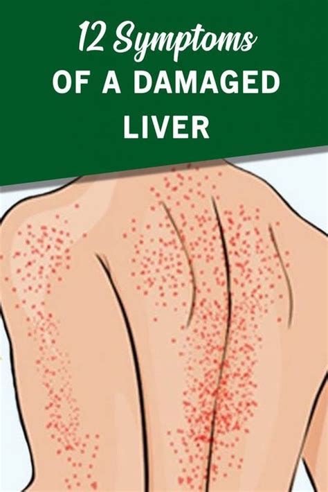 12 Symptoms Of A Damaged Liver Your Health Liver Health Liver