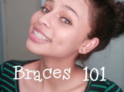 Braces 101 Typescostand How To Get Them Cheap Braces Orthodontist Invisalign