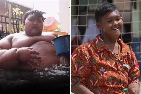 Worlds Fattest Kid Drops More Than 200 Pounds After Gastric Bypass
