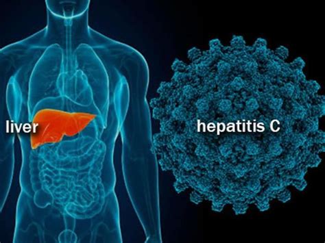 India Develops Cheap Effective Treatment Against Hep C A Fatal Liver