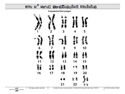 Autosome, chromosomal disorder, chromosome in the human karyotyping gizmo, you will make karyotypes for five individuals. Mariano A. Aure, Jr.