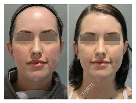 6602 Schmidt Facial Plastic Surgery