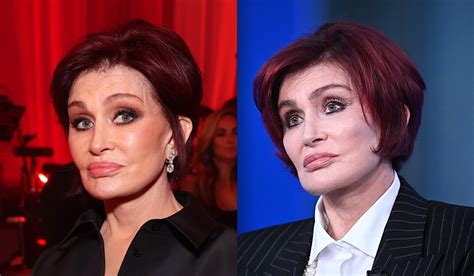 Sharon Osbourne Claims She Is Done With Plastic Surgery ‘i Really