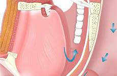 apnea sleep osa obstructive atrial nocturnal risk hypoxemia disorders fibrillation types afib increases linked pulmonologyadvisor different high