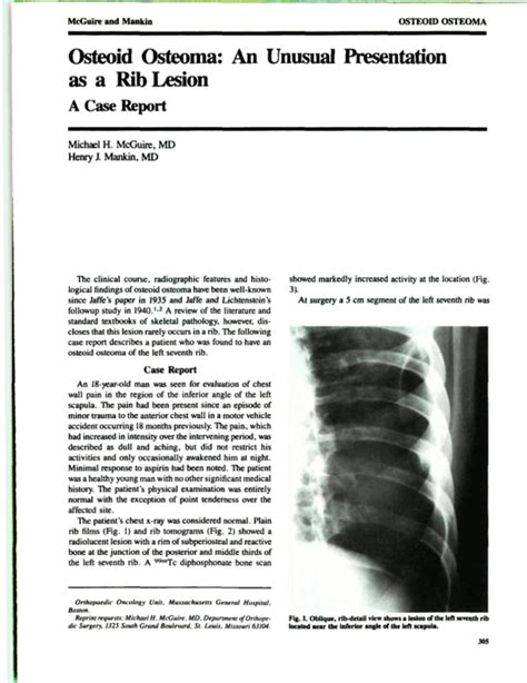 Osteoid Osteoma An Unusual Presentation As A Rib Lesion A Case Report