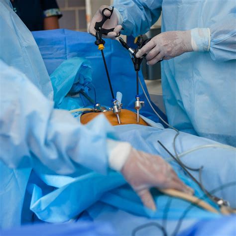 Minimally Invasive And Endoscopic Surgery Hk Surgeon